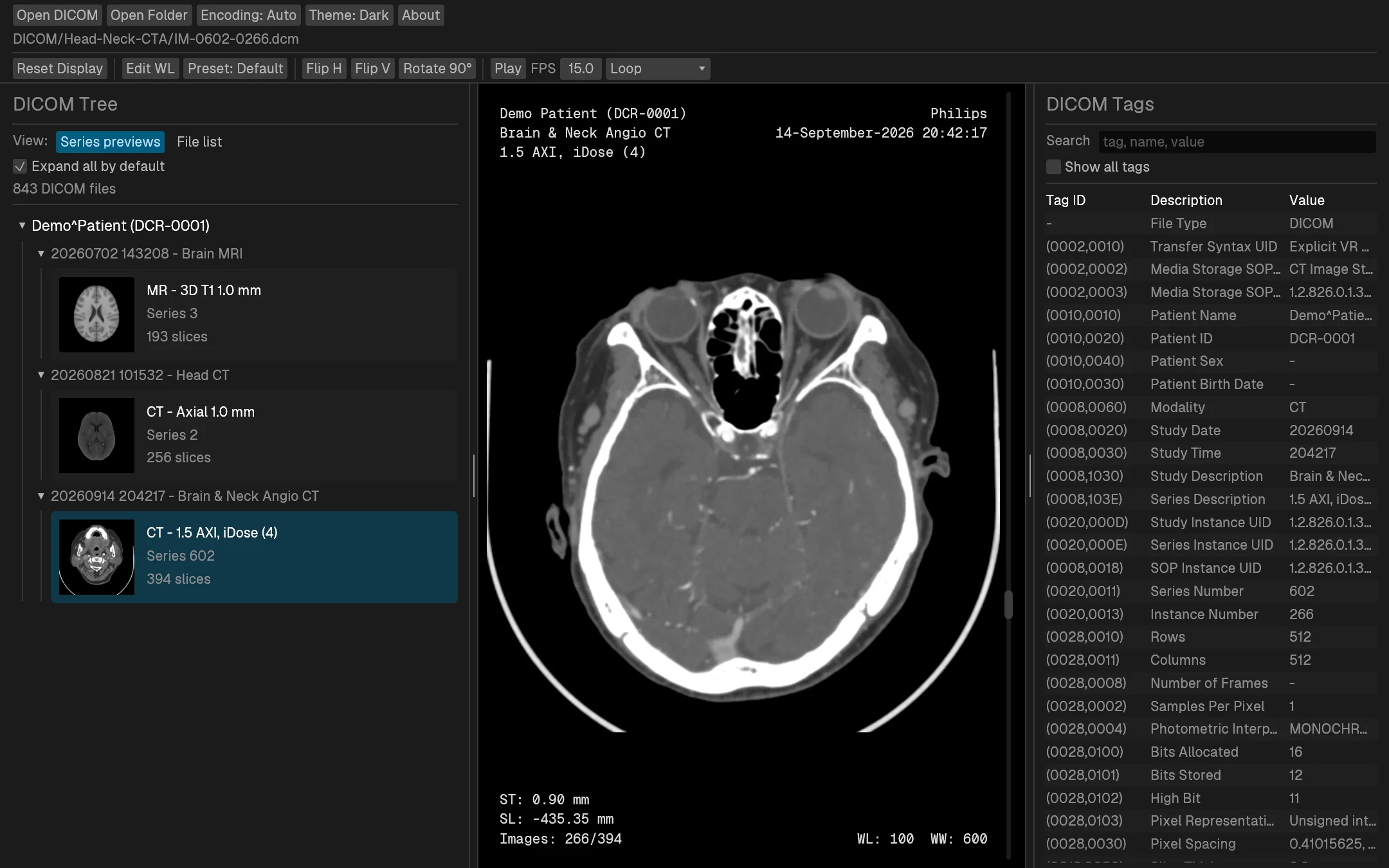 Dicron showing a head and neck CT angiography slice, with the DICOM tree of series thumbnails on the left and the DICOM tag table on the right.